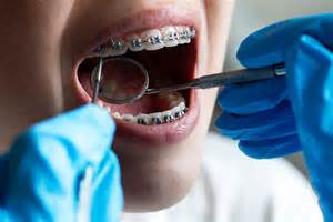 180 patients en une journée : l’orthodontiste rouennaise condamnée pour escroquerie et abus de biens sociaux